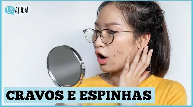 Neste episódio, a Dermatologista Dra. Vivian Barzi Loureiro explica sobre o diagnóstico e tratamento dos cravos
