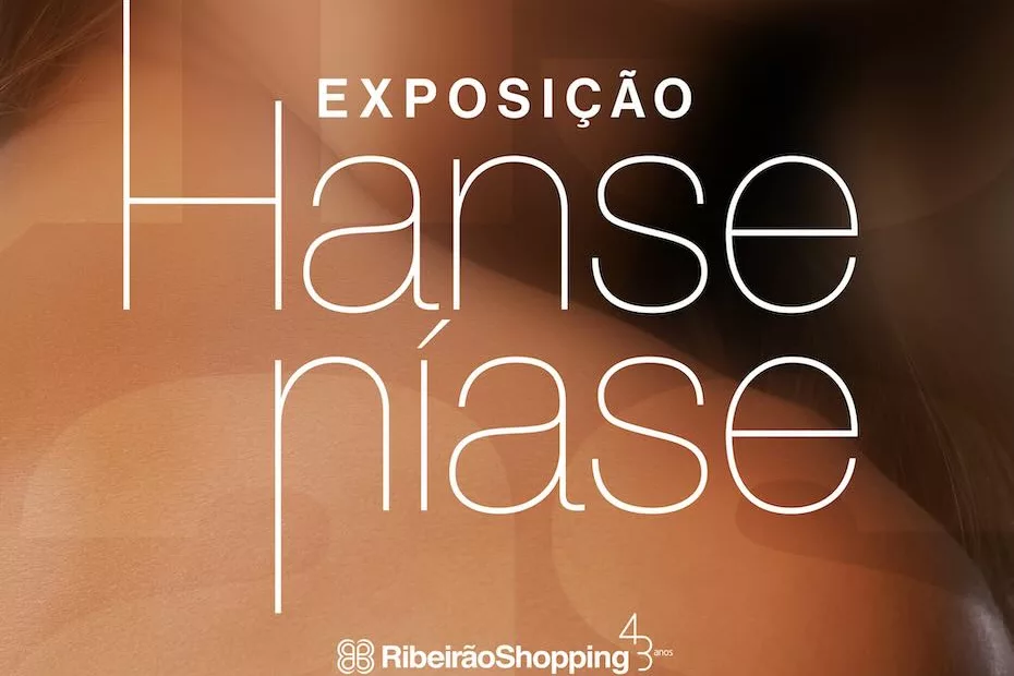 Exposição no RibeirãoShopping alerta para a conscientização da hanseníase