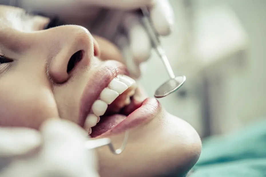 Mitos e verdades sobre a limpeza dental profissional para um sorriso saudável